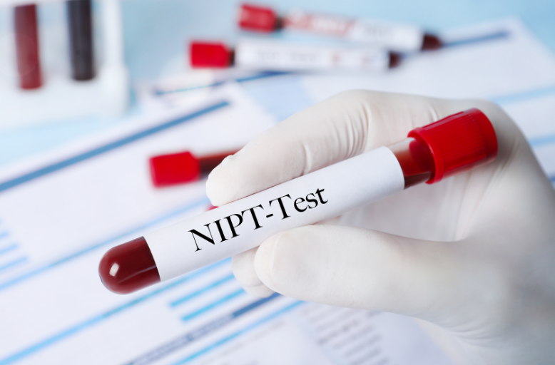 Kiedy wykonać test NIPT