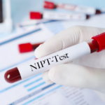 nieprawidlowy wynik testu nipt co dalej