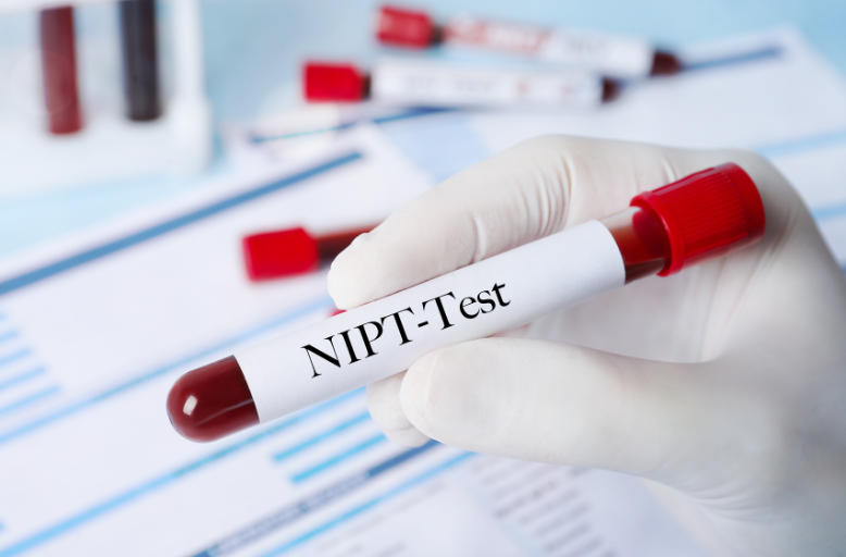 nieprawidlowy wynik testu nipt co dalej