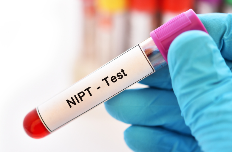 Co oznacza, że test NIPT ma czułość 99%